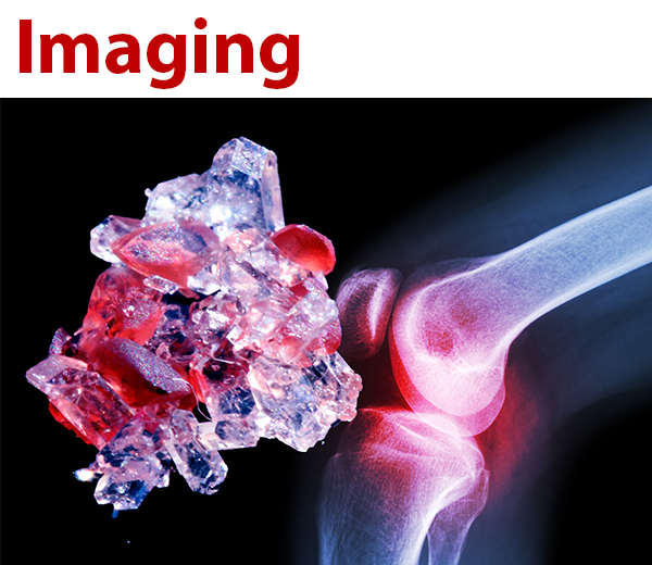 Kachel-Imaging-T.jpg