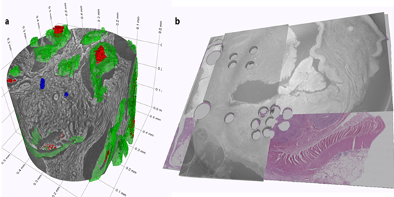 3D+virtual+precision+medicine.png