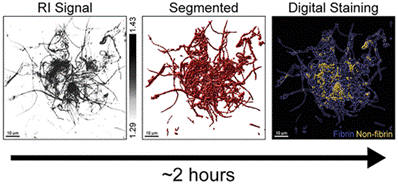 Imaging+microclots.gif