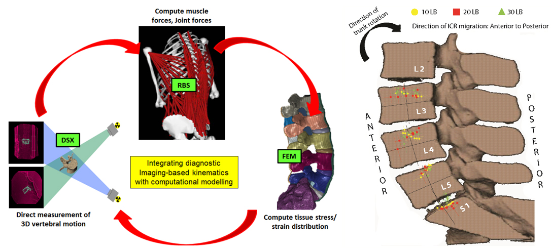 Fig+3+Dynamic+Stereo+xray.jpg