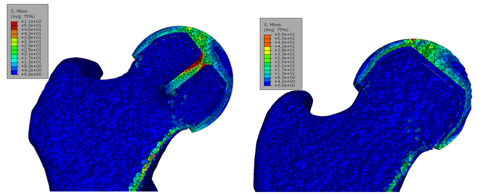 Fig+7+Principal+stress+distribution.jpg