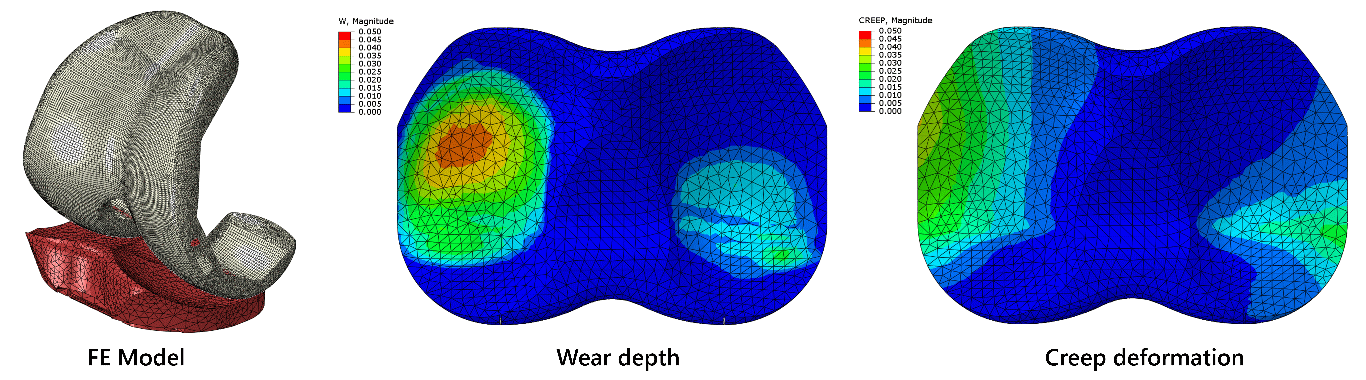 Fig.+12+Left+Example+of+a+FE+knee+implant+model.png