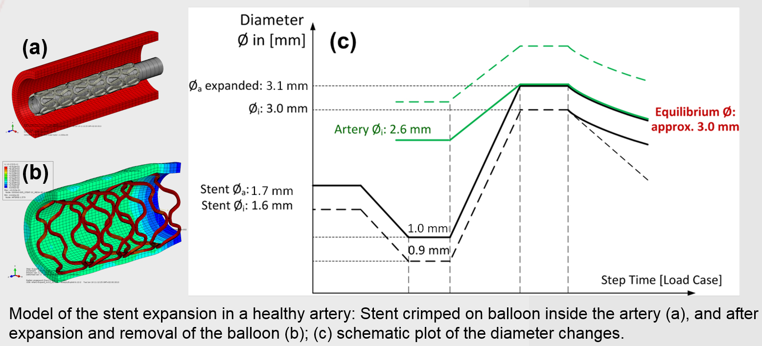 /documents/55968/82331/Fig+10+Finite+Element+Model/f1a213c3-8f19-4330-8480-308ebe665170?t=1534771553747