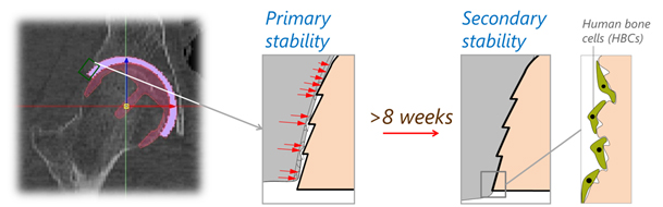 /documents/55968/82331/Fig+8+Illustration+of+osseointegration/1a2bb52e-bd2b-451b-8a6f-6d2bed558d34?t=1534771485130