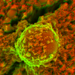nanoCalcification.png