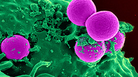 Bacteria+stopper.jpg