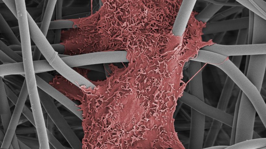 cell+colour_SEM.jpg