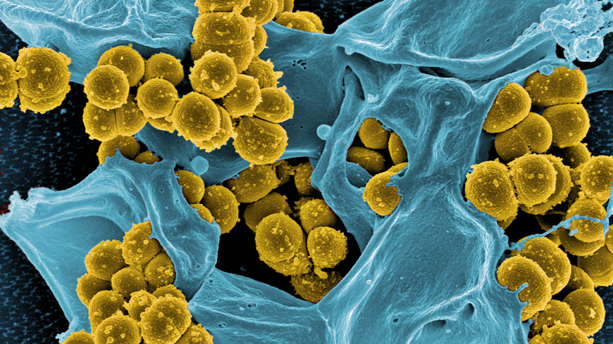 MRSA-viele-blau-870.png