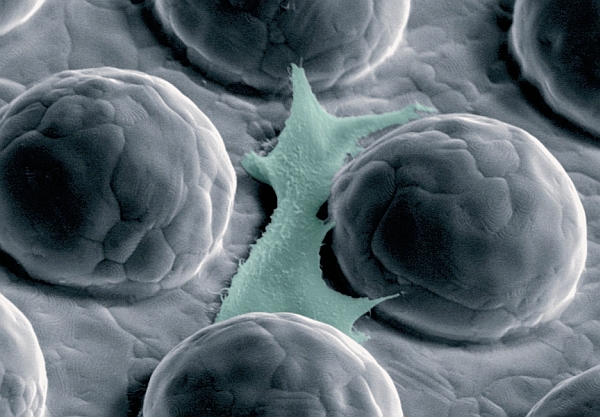 a592-2012-10-04-b0x+stopper+Oberfl%C3%A4chenimplantate.jpg