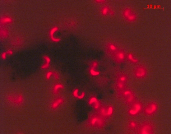 a592-2011-11-03-b1x+Nanoroehrchen.jpg