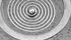 a592-2008-09-16-b1s+stopper+Knochenimplantate.jpg
