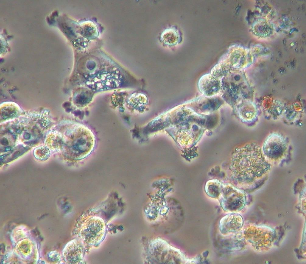 a592-2006-05-02-Nanorisk-b1m.jpg