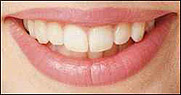 a592-2004-05-07-b7s_l%C3%A4cheln.jpg