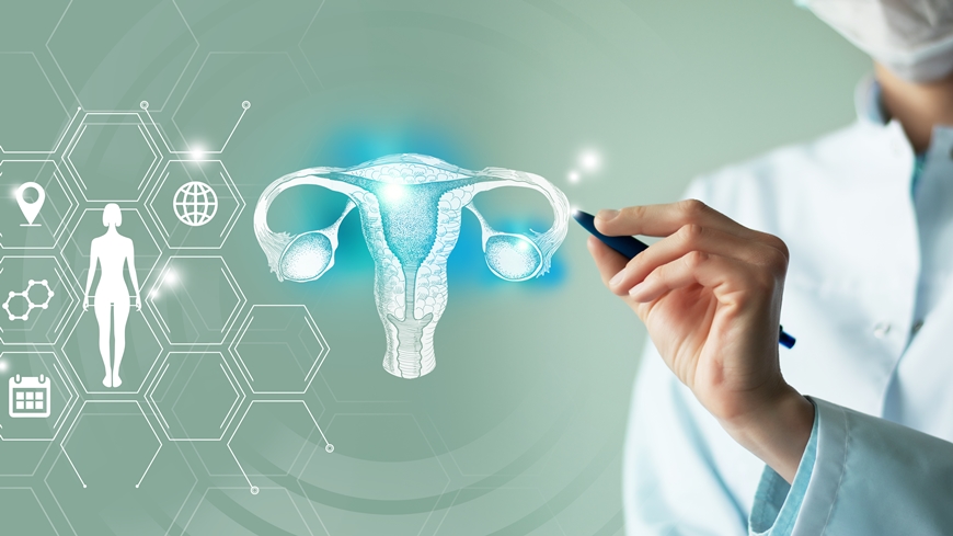 Hydrogel-Endometriose-stopper.jpeg