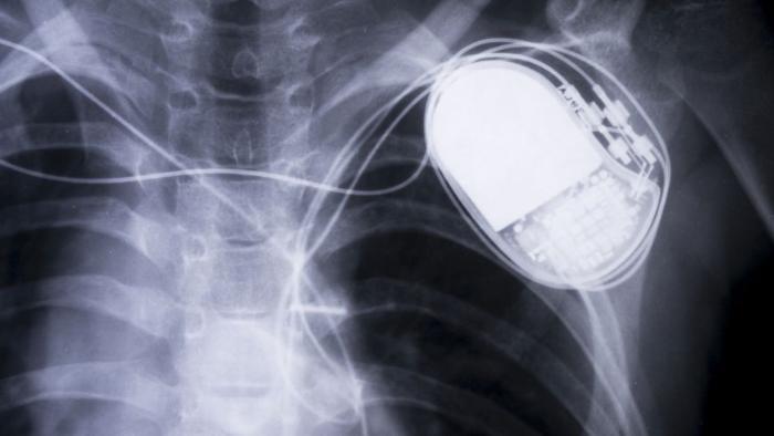 Pacemaker
