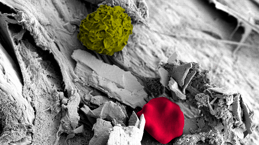 Biofilm+EQ65+Stopperbild.png