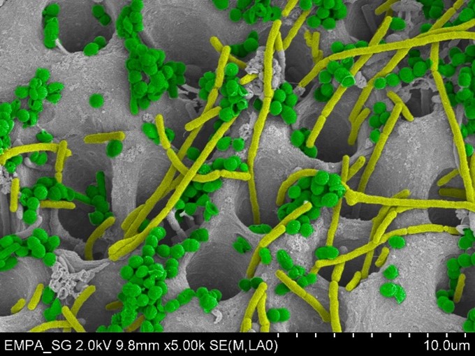 Images Microbes on theeth canals
